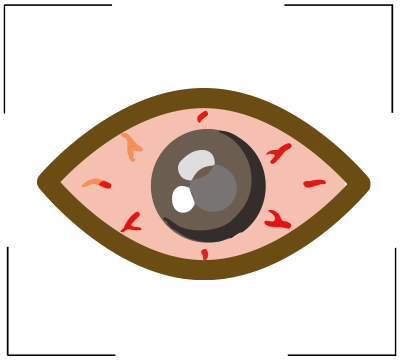 Icon of Eye Conditions